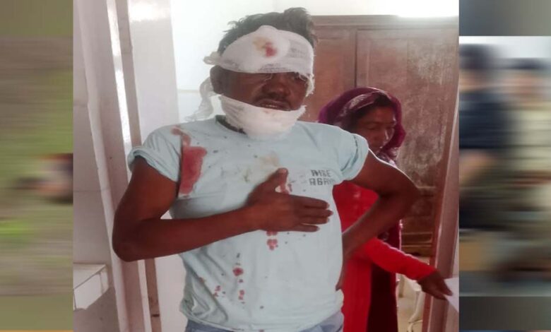 ब्रेकर-में-बाइक-जैंपिंग-होने-से-हादसा:-चालक-को-आया-गंभीर-रूप-से-जख्म