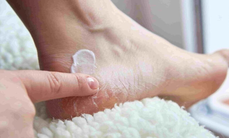 फटी-एड़ियों-की-छुट्टी!-6-घरेलू-नुस्खों-से-पाएं-मक्खन-जैसी-मुलायम-एड़ियां