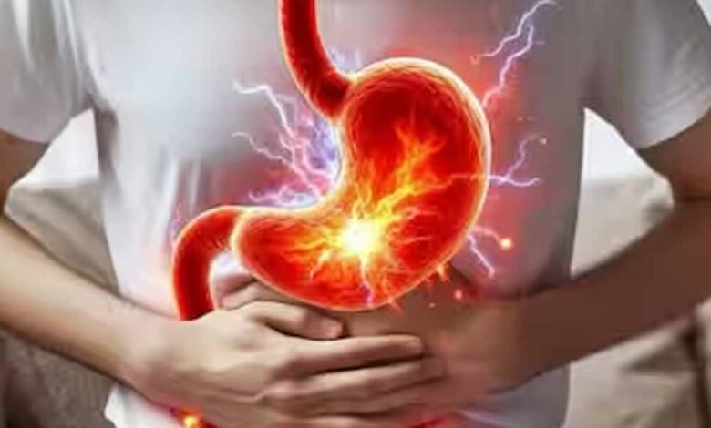 अल्सर-से-कैसा-डर!-जानिए-इलाज-और-बचाव-के-आसान-तरीके