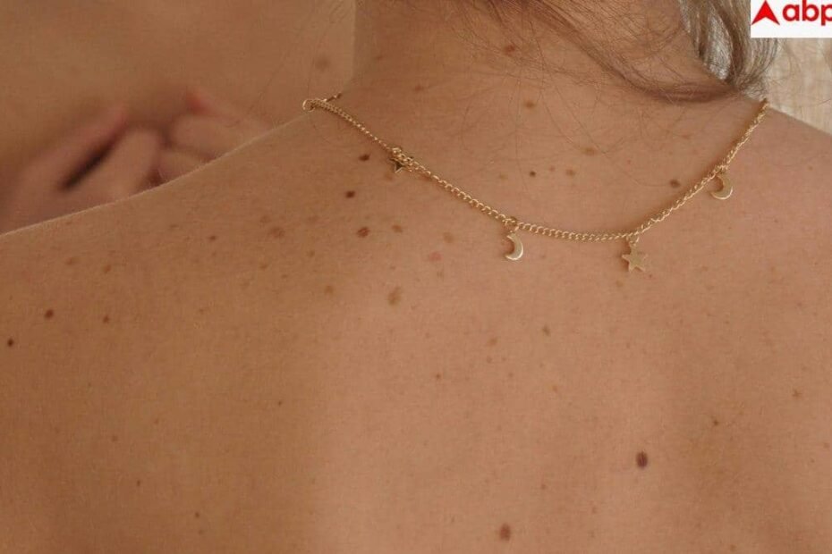 psoriasis-symptoms:-क्या-सच-में-नहीं-होता-सोराइसिस-का-कोई-इलाज,-जानें-कितनी-खतरनाक-है-यह-बीमारी?