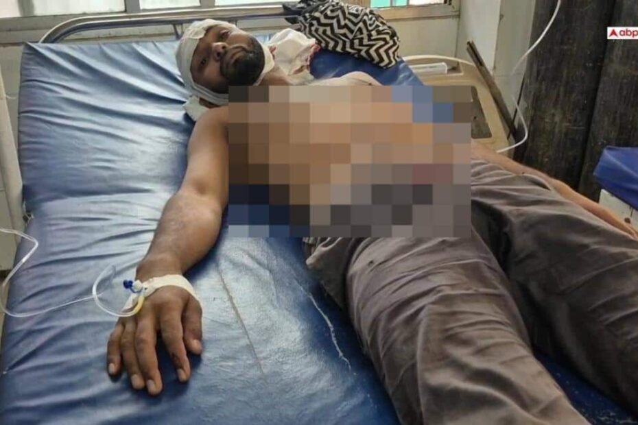 महोबा-में-आधा-दर्जन-से-अधिक-बदमाशों-ने-युवक-को-पीटा,-बीच-बचाव-करने-आए-सपा-नेता-पर-भी-हमला