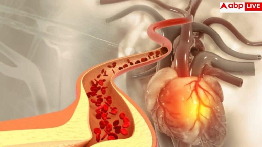 high-cholesterol:-इस-बीमारी-में-भी-राहत-देती-है-कोलेस्ट्रॉल-की-यह-दवा,-नई-स्टडी-में-सामने-आई-चौंकाने-वाली-बात