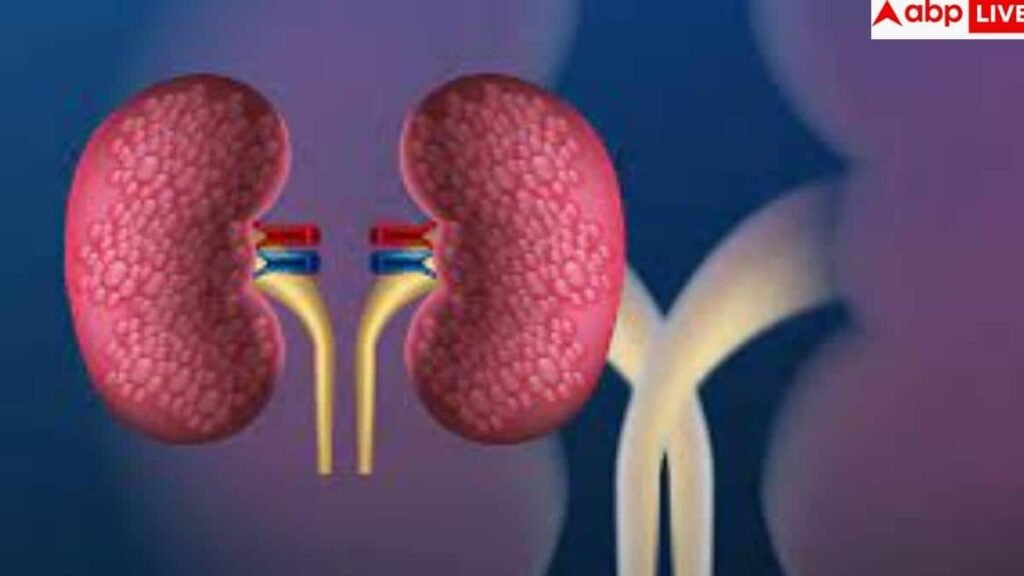 kidney-health:-किडनी-को-रखना-है-हेल्दी-तो-आज-ही-अपना-लें-ये-8-गोल्डन-रूल्स,-डॉक्टर-की-भी-नहीं-पड़ेगी-जरूरत