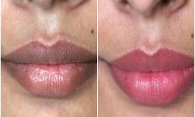 काले-होंठों-को-नेचुरली-गुलाबी-बनाएंगे-ये-7-घरेलू-नुस्खे,-महंगे-लिप-बाम-की-नहीं-पड़ेगी-जरूरत