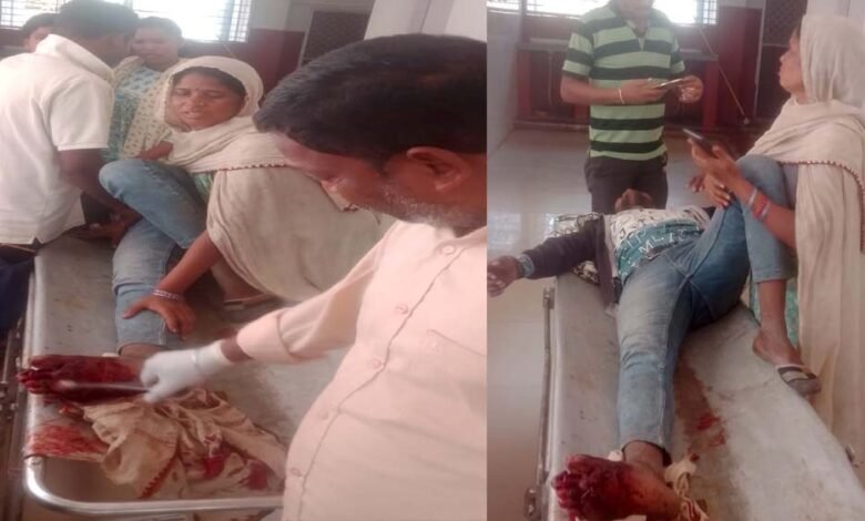 ऑटो-और-बाइक-की-भिंडत,-बाइक-चालक-को-आया-गंभीर-चोटें-पैर-की-दो-उंगली-टूटने-की-आशंका