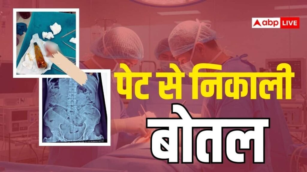 अंबेडकर-नगर:-शरीर-के-अंदर-युवक-ने-पेट-में-डाल-ली-बोतल,-डॉक्टरों-ने-सर्जरी-कर-बचाई-जान