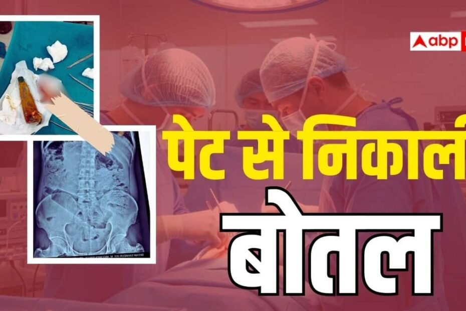 अंबेडकर-नगर:-शरीर-के-अंदर-युवक-ने-पेट-में-डाल-ली-बोतल,-डॉक्टरों-ने-सर्जरी-कर-बचाई-जान