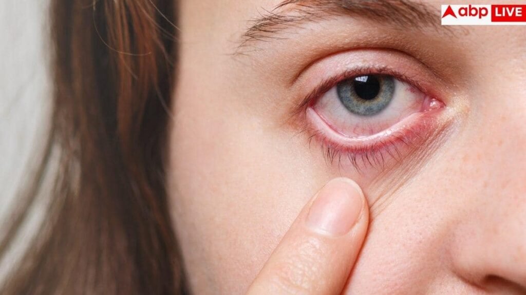 bleeding-from-eyes-cause:-आंखों-से-खून-बहने-से-20-साल-की-लड़की-की-मौत,-जानें-क्या-है-यह-बीमारी-और-कितनी-खतरनाक?