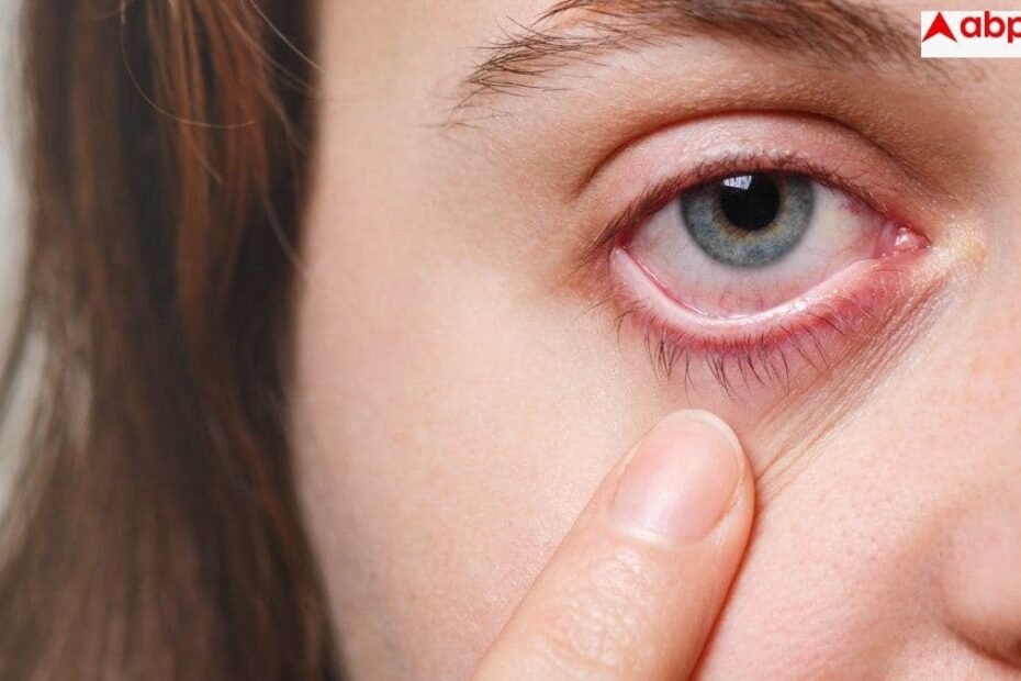 bleeding-from-eyes-cause:-आंखों-से-खून-बहने-से-20-साल-की-लड़की-की-मौत,-जानें-क्या-है-यह-बीमारी-और-कितनी-खतरनाक?