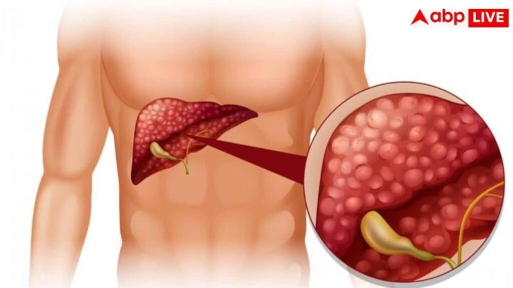 liver-disease-symptoms:-क्या-आपकी-हथेलियां-भी-रहती-हैं-लाल?-डॉक्टर-ने-दी-चेतावनी,-लिवर-की-बीमारी-का-हो-सकता-है-संकेत