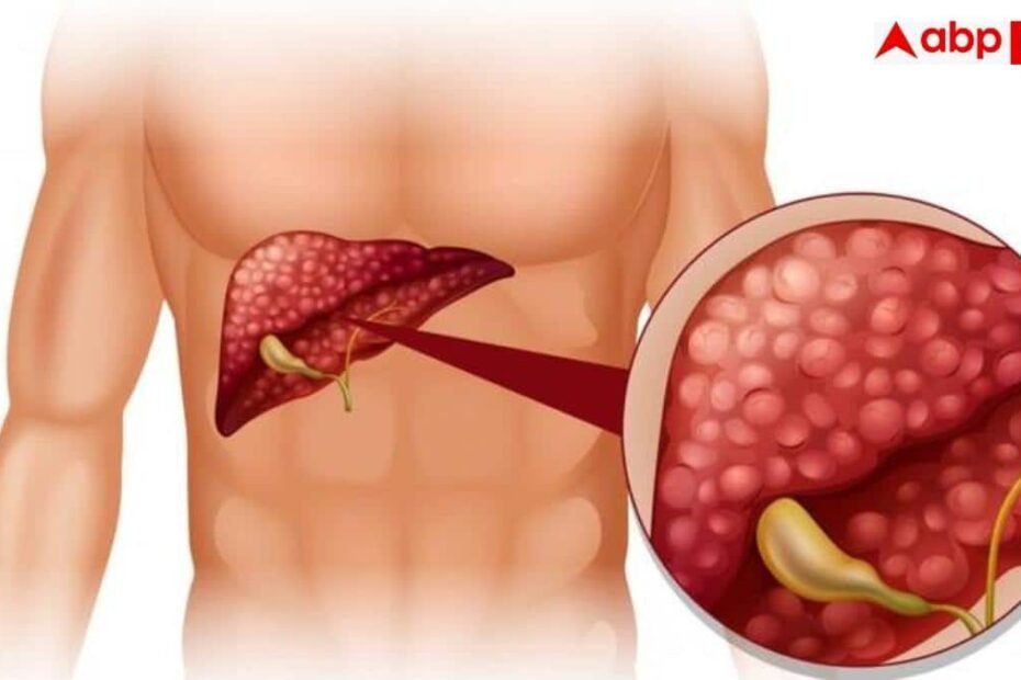 liver-disease-symptoms:-क्या-आपकी-हथेलियां-भी-रहती-हैं-लाल?-डॉक्टर-ने-दी-चेतावनी,-लिवर-की-बीमारी-का-हो-सकता-है-संकेत