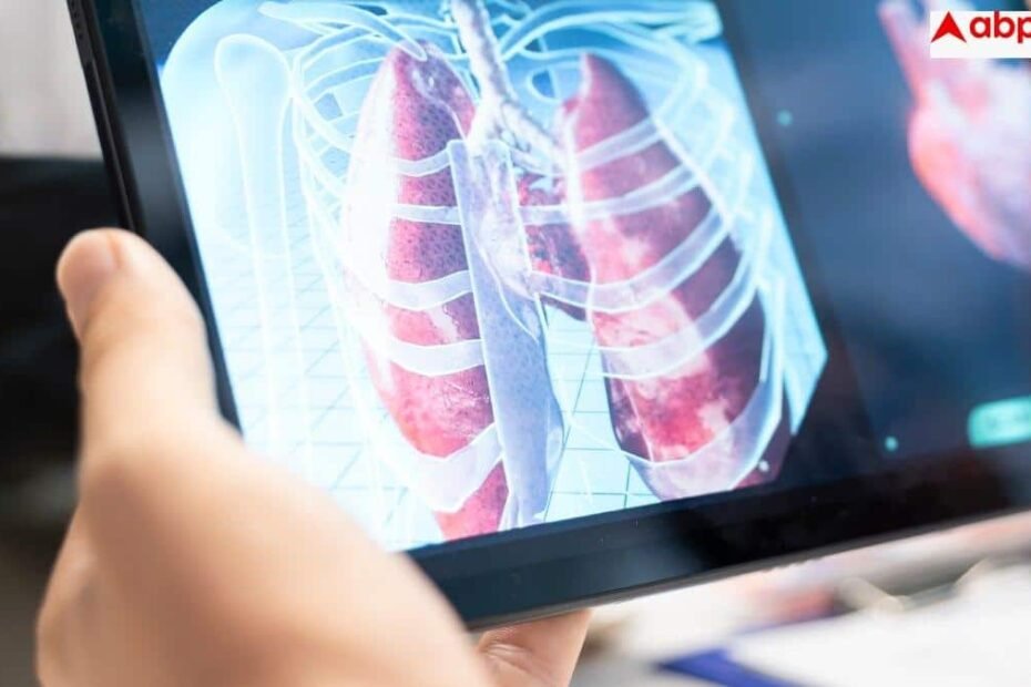 lung-cancer-early-signs:-3-हफ्ते-से-ज्यादा-रहने-वाली-खांसी-सामान्य-नहीं,-फेफड़ों-के-कैंसर-के-ये-संकेत-न-करें-नजरअंदाज