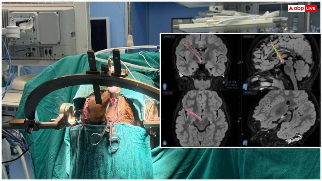 laughing-epilepsy-symptoms:-आपकी-हंसी-भी-हो-सकती-है-खतरनाक-बीमारी,-जानें-इसके-लक्षण-और-इलाज-का-तरीका