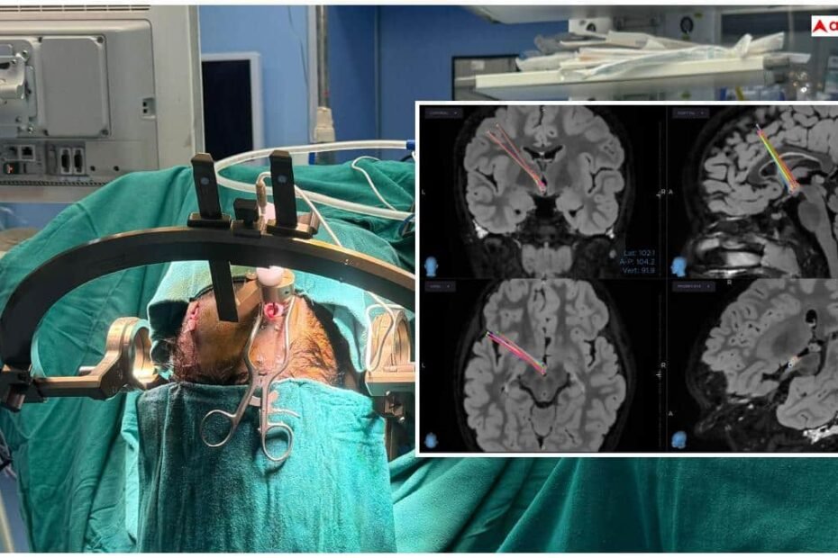 laughing-epilepsy-symptoms:-आपकी-हंसी-भी-हो-सकती-है-खतरनाक-बीमारी,-जानें-इसके-लक्षण-और-इलाज-का-तरीका