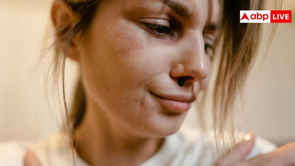 nose-bleeding:-गर्मियां-शुरू-होते-ही-नाक-से-निकलने-लगता-है-खून,-जानें-कब-नॉर्मल-और-कब-है-टेंशन-लेने-की-जरूरत?