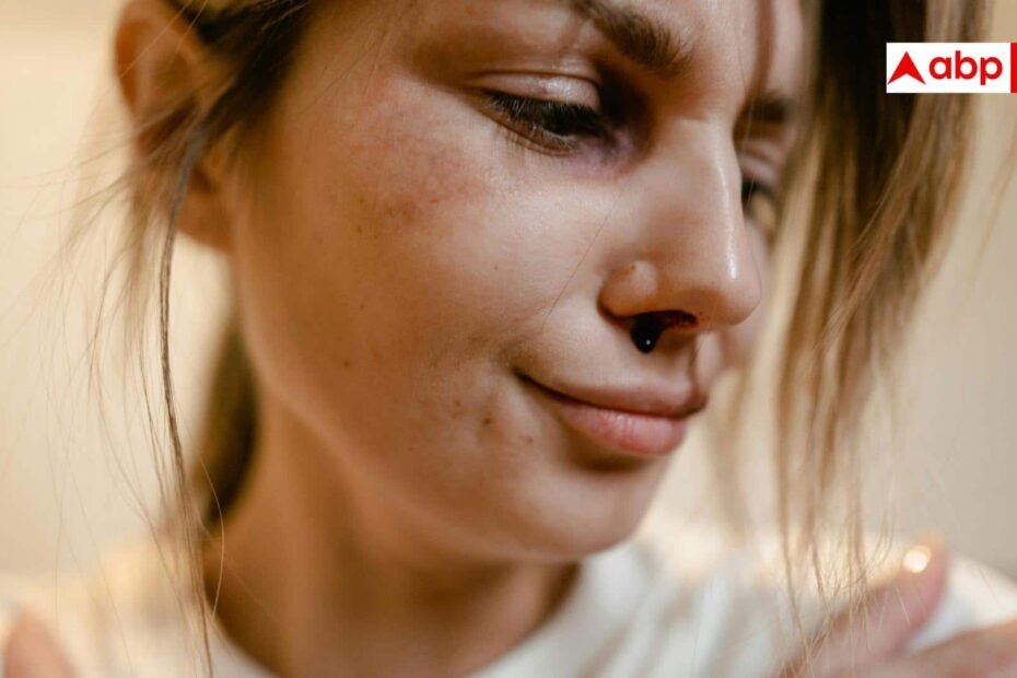 nose-bleeding:-गर्मियां-शुरू-होते-ही-नाक-से-निकलने-लगता-है-खून,-जानें-कब-नॉर्मल-और-कब-है-टेंशन-लेने-की-जरूरत?