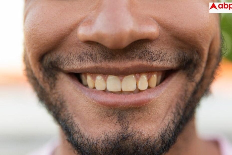 sugar-effects-on-teeth:-क्या-चीनी-खाने-से-पीले-होते-हैं-दांत,-जानें-इससे-डायबिटीज-के-अलावा-क्या-हो-सकती-हैं-दिक्कतें?