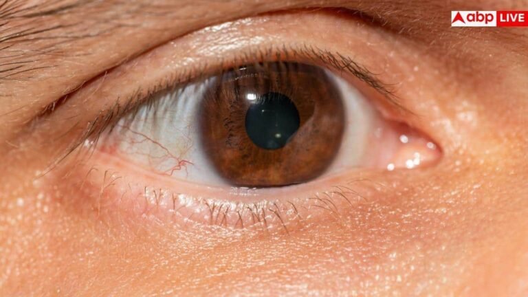 imran-khan-wife-health-update:-इमरान-खान-की-बेगम-बुशरा-बीबी-को-हुआ-‘रेटिनल-डिटैचमेंट’,-जानें-क्या-है-आंखों-की-यह-गंभीर-बीमारी?